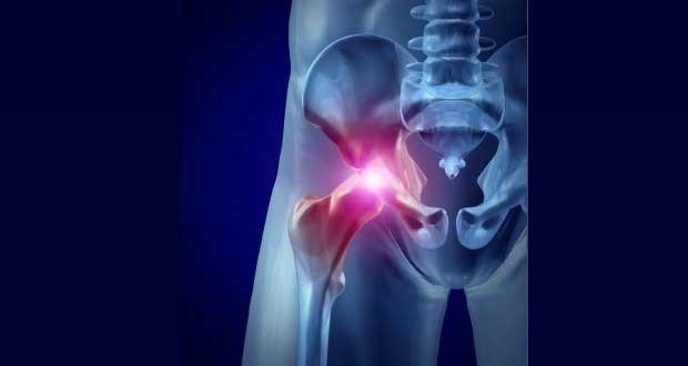 Image result for Hip Flexor Pain