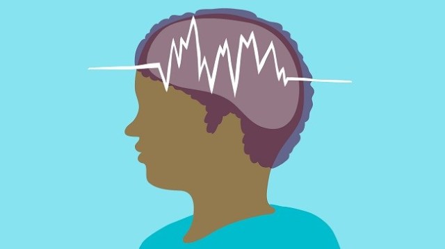 Epilepsy Epilepsy